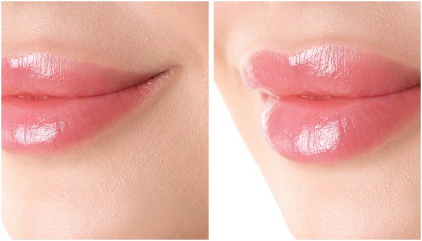 Key Components of an Effective Lip Care Routine